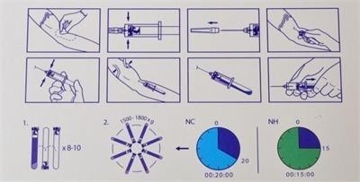 6/8x15ml Portatif PRP Merkezci Cihazı 0-4000 rpm Kozmetik Cerrahi Hastaneleri İçin